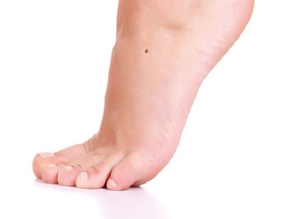 Vị trí bói nốt ruồi ở chân phụ nữ: mu bàn chân